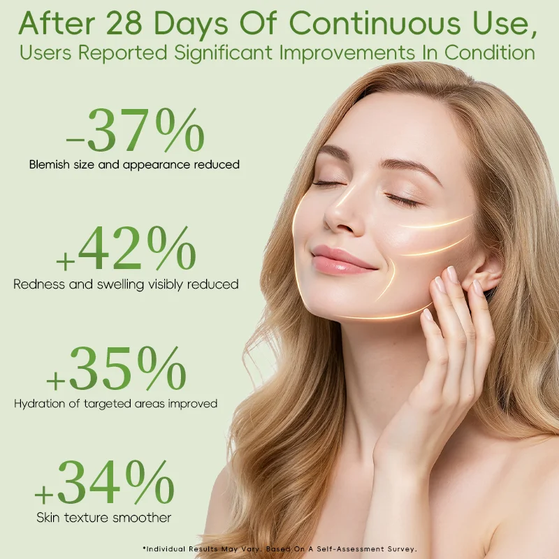 Infographic showing skin improvement results after 28 days, with a woman touching her face and statistics on blemish reduction, redness reduction, hydration, and texture smoothing.